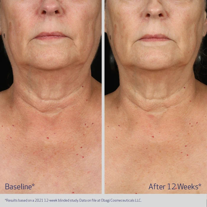 Obagi ELASTIderm Neck and Decollete Concentrate