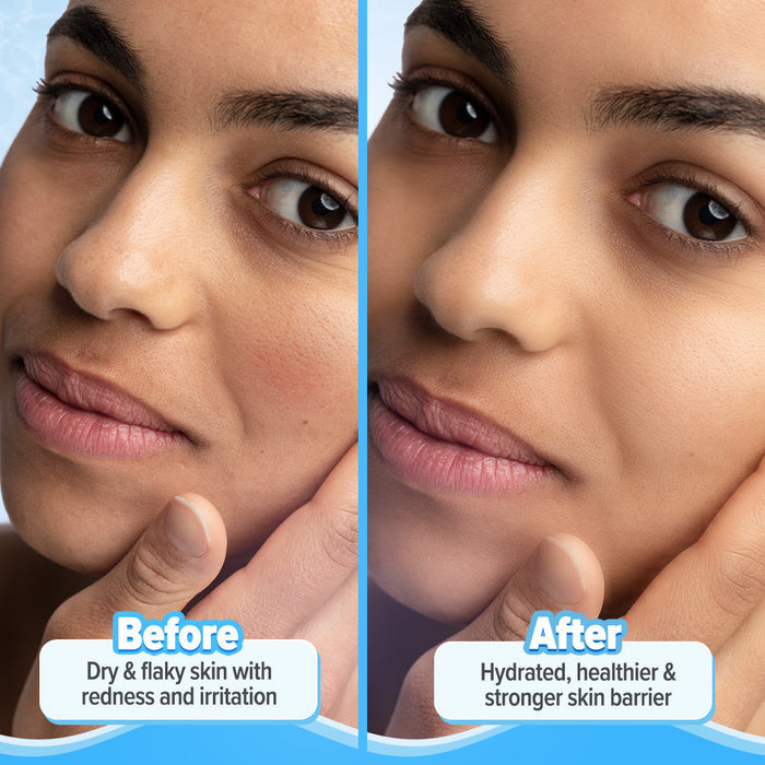 Before-and-after skin panel showing improved texture