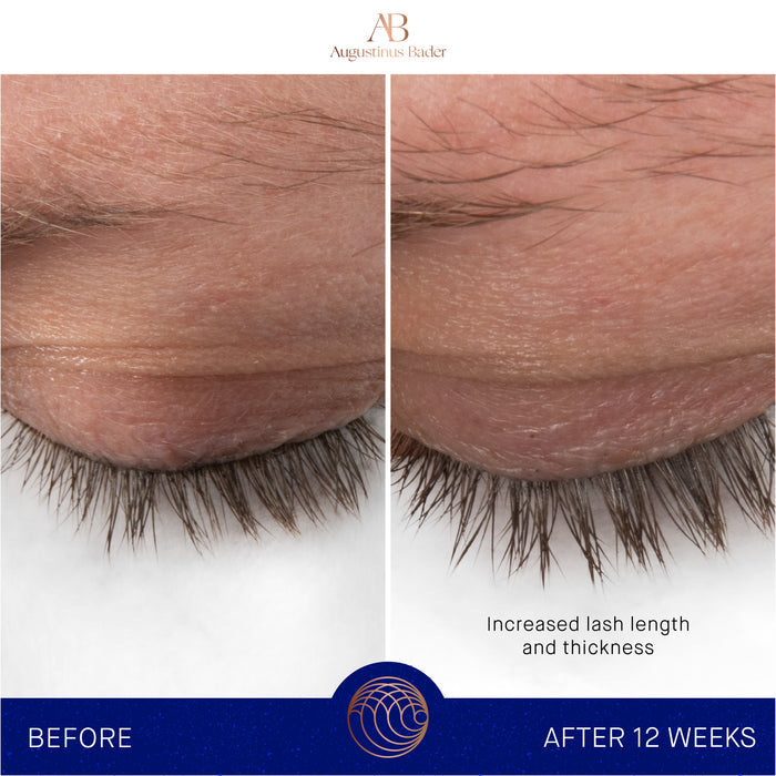 Augustinus Bader lash serum before-and-after showing increased lash length and thickness after 12 weeks