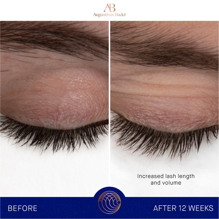 Augustinus Bader eyebrow and lash serum before and after 12 weeks, showing longer, fuller lashes