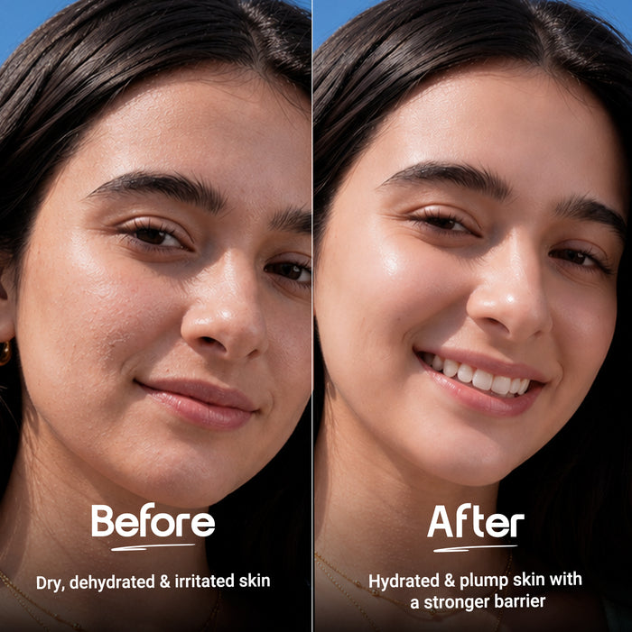 Barrier+ Hydra Melt Gel Moisturizer with  2% Cera-Hyaluron Complex™ & Avocado - 100 g