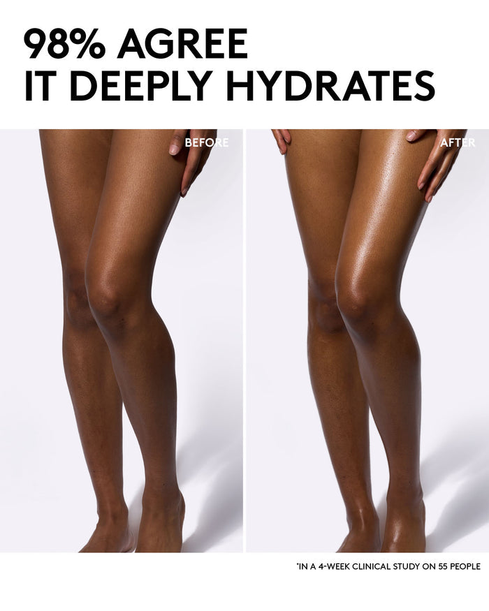 Before and after comparison of legs with hydration text.