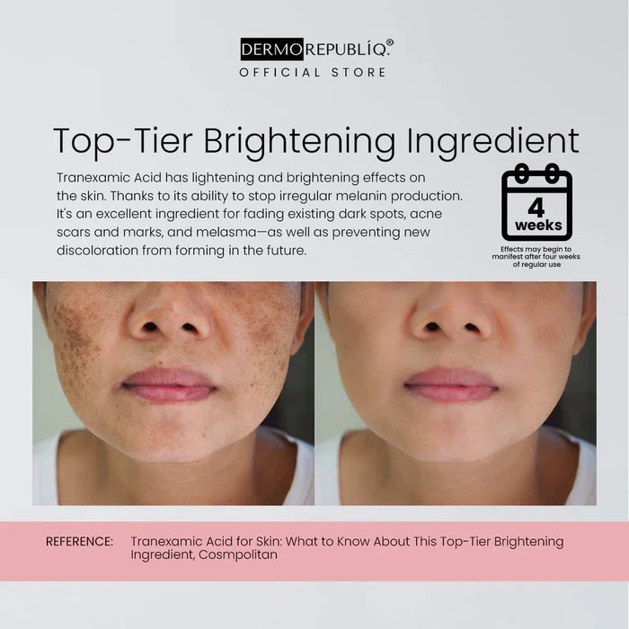 Dermorepubliq 10% Niacinamide + 3% Tranexamic Acid + 2% Alpha Arbutin Ultra White Serum 30mL