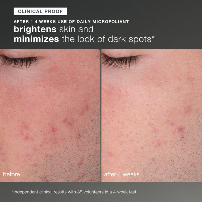 discover healthy skin kit clinical