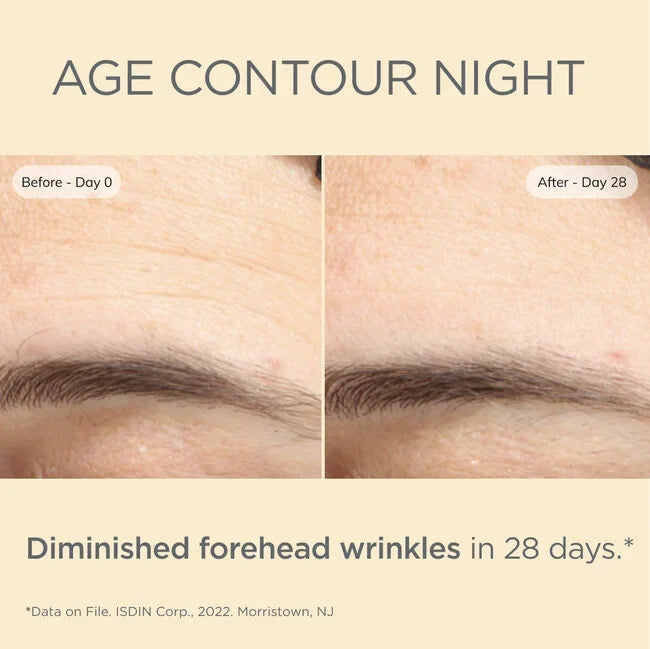 ISDIN Age Contour Night before-and-after forehead wrinkles in 28 days