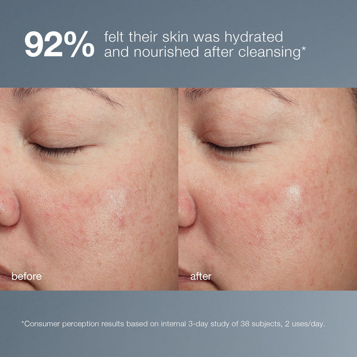 magnetic[+] afterglow cleanser before and after
