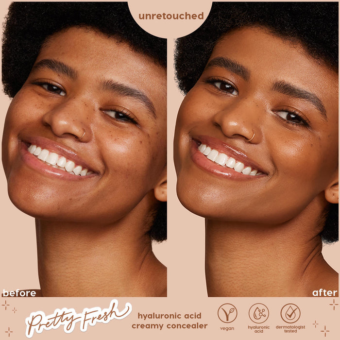 ColourPop Pretty Fresh Creamy Concealer in Medium Dark 115 W enhancing a smiling model’s complexion - side-by-side before and after close-up shows smoother, more even coverage; unretouched, hyaluronic acid, vegan, dermatologist tested.
