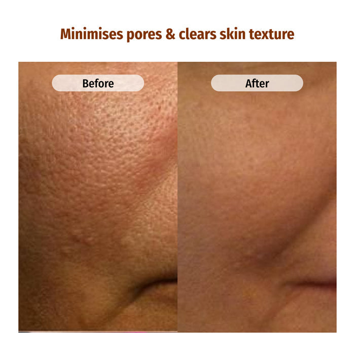 vilvah milk face toner minimises pores and clears skin texture