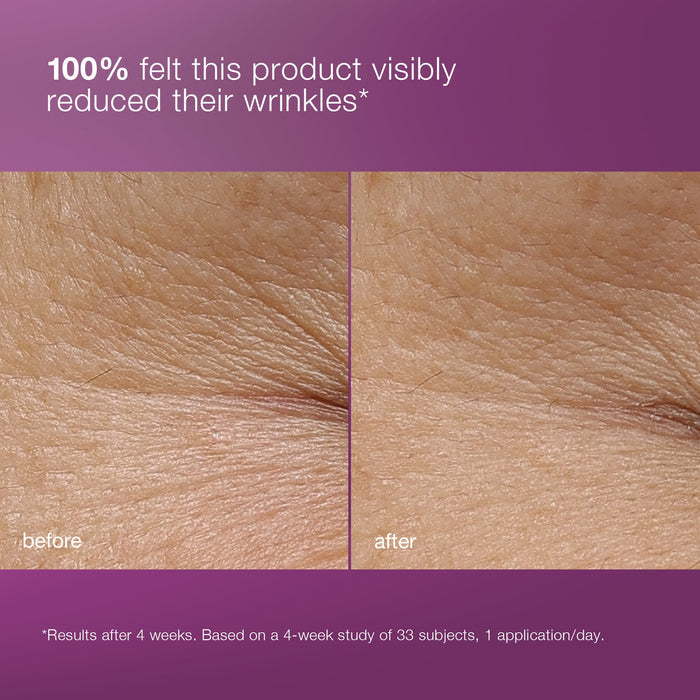 multivitamin power recovery cream before and after