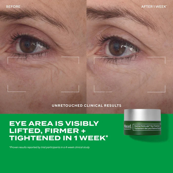 Murad Retinal ReSculpt Eye Lift Treatment