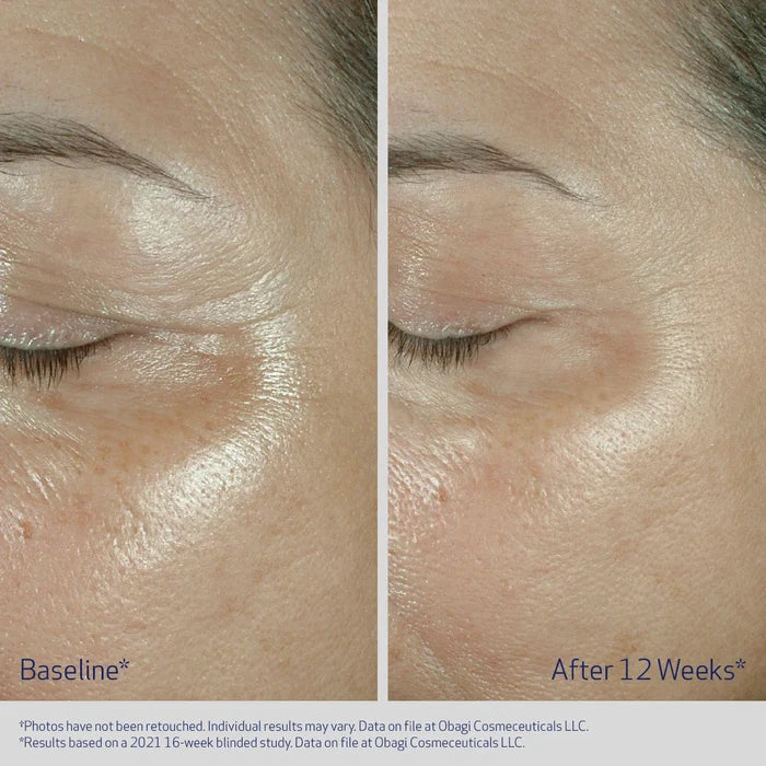 Obagi ELASTIderm Firming Eye Cream