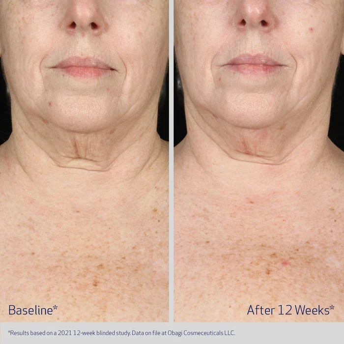 Obagi ELASTIderm Neck and Decollete Concentrate