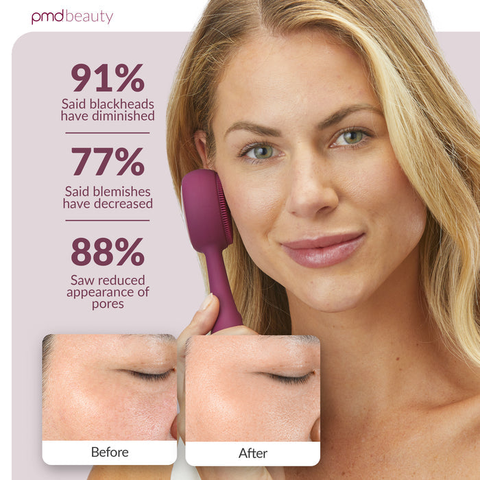 PMD Sonic Facial Cleansing Device