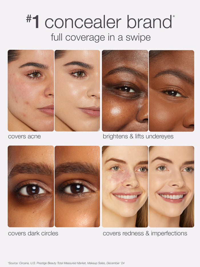 Concealer advertisement showing its effectiveness on various skin imperfections with close-up images of faces.