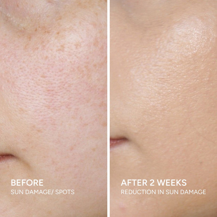 before and after using vilvah skin finish sunscreen