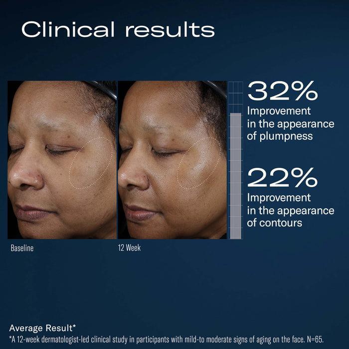 Clinical results showing baseline and 12-week facial plumpness and contour improvement, 32% and 22%
