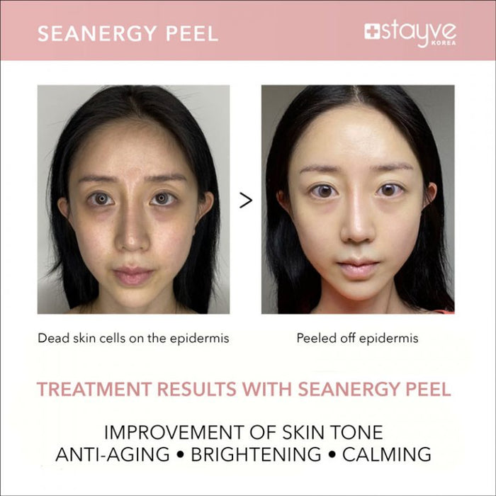 Stayve Seanergy Peel Kit – 5 Ampoules & 5 Solutions for Powerful Skin Renewal - SD Cosmetics Care